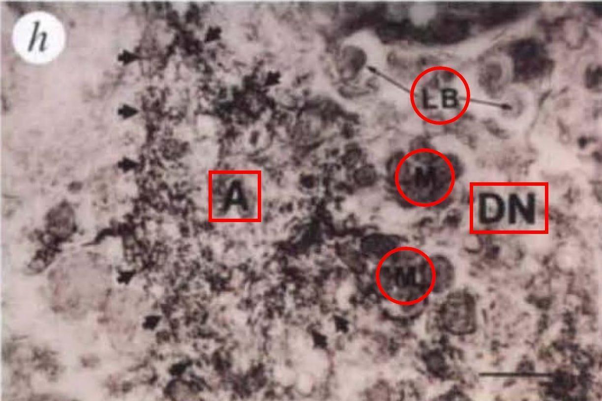 A close-up of a microscope
AI-generated content may be incorrect.